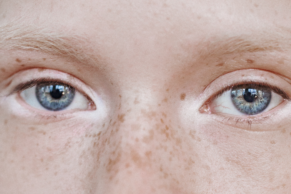 How To Depuff Your Eyes This Morning