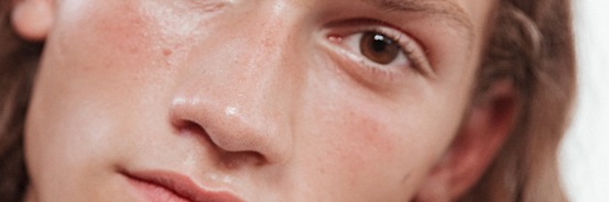 Level Up Your Skincare Routine With A Peel